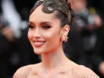 Cinta Laura Jalani Operasi Akibat Pisau Daging