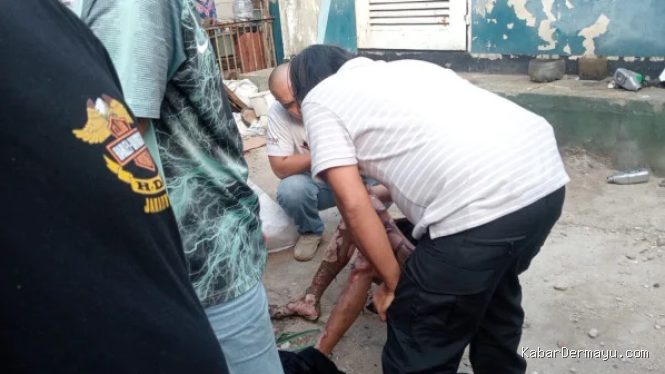 Curi Kabel Gardu di Tanjung Priok, Pria Ini Tersengat Listrik hingga Luka Bakar 70%