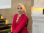Ria Ricis Akui Operasi Hidung Demi Kecantikan