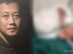 Sederet Kekerasan yang Dilakukan Taufik Hidayat ke YTR: Disundut Rokok, Dipukul Helm, Hingga Dihantam Meja