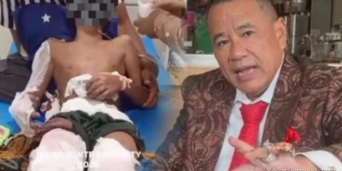 Santri di Lombok Dibakar, Menangis Minta Pulang, Hotman Paris Laporkan Kapolres