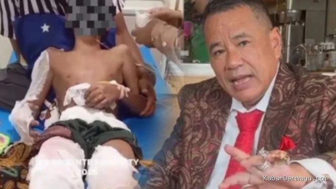 Santri di Lombok Dibakar, Menangis Minta Pulang, Hotman Paris Laporkan Kapolres