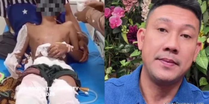 Santri Korban Pembakaran di Lombok Batal ke Jakarta Temui Denny Sumargo, Tunggu Izin