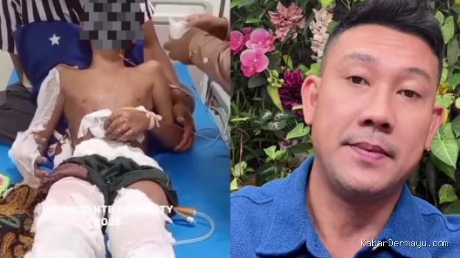 Santri Korban Pembakaran di Lombok Batal ke Jakarta Temui Denny Sumargo, Tunggu Izin
