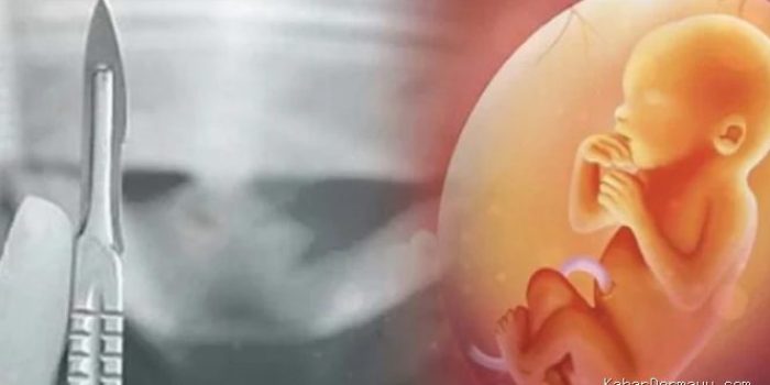 Dugaan Aborsi Paksa oleh Runner Up Raka-Raki Jawa Timur Viral
