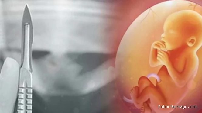 Dugaan Aborsi Paksa oleh Runner Up Raka-Raki Jawa Timur Viral