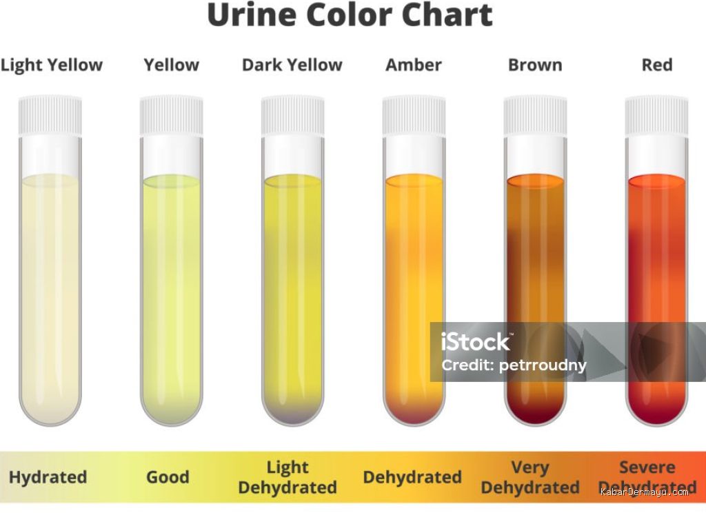 Photo by istockphoto.com - Penyebab Hasil Tes Urin MCU Kerja Menunjukkan Tanda Protein Tinggi