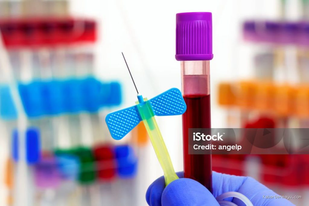 Penyebab Darah Rendah Anemia Membuat Peserta Gagal Tes Darah Rutin MCU