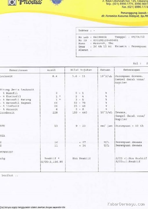 Penyebab SGOT dan SGPT Hati Melonjak Tinggi di Lembar Hasil Laboratorium
