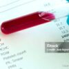 Penyebab Status Hepatitis B HBsAg Reaktif Menggagalkan Kerja Luar Negeri