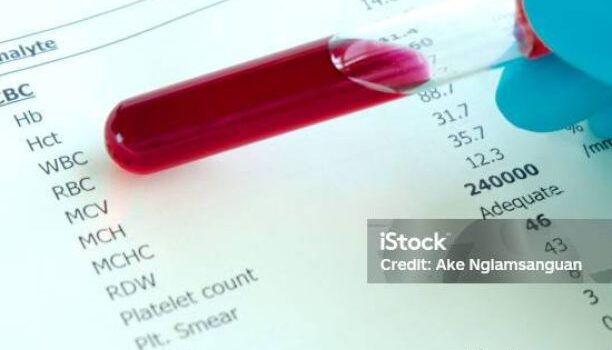 Penyebab Status Hepatitis B HBsAg Reaktif Menggagalkan Kerja Luar Negeri