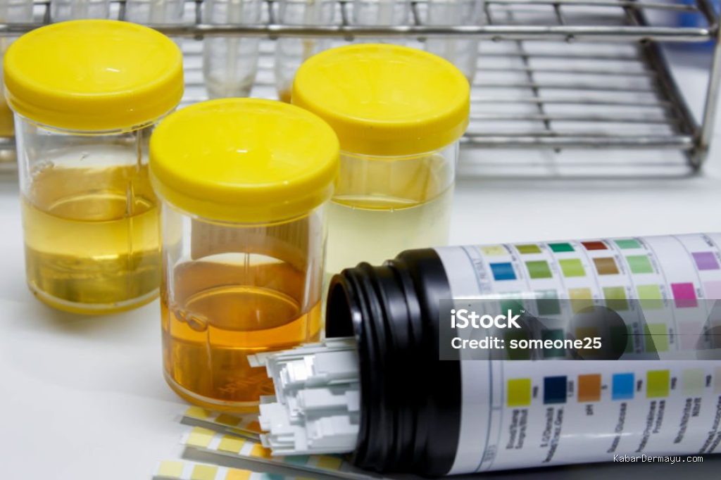 Photo by istockphoto.com - Penyebab Urine Keruh Kuning Gelap Pasca Begadang Malam Sebelum Tes Kesehatan